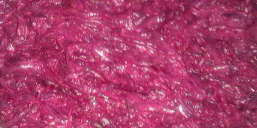 селедочка под шубой