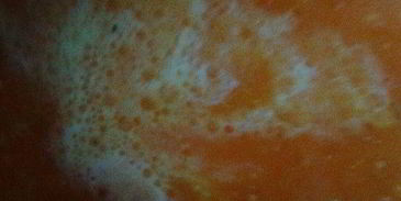 суп-пюре из тыквы с фрикадельками